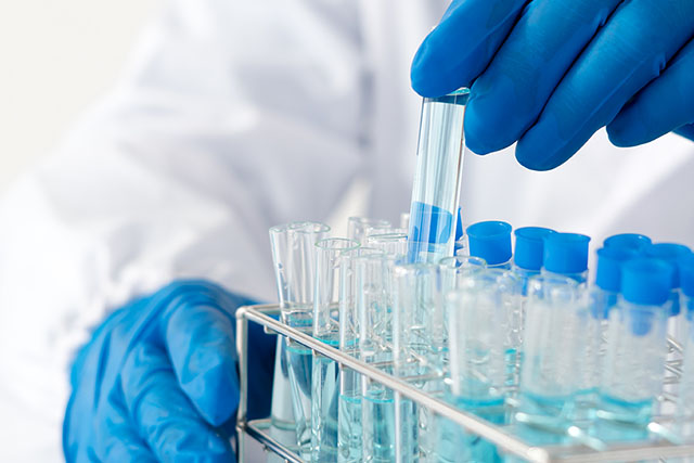 検査のイメージ